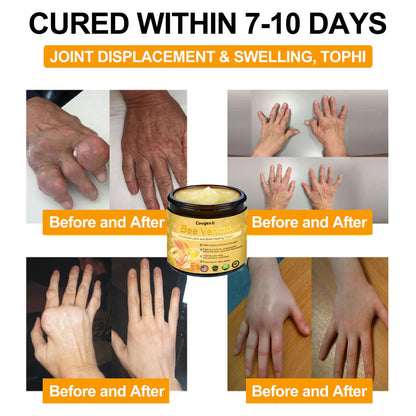 🔥Black Friday Limited Time 50% OFF🔥Bee Venom Advanced Joint and Bone Healing Cream