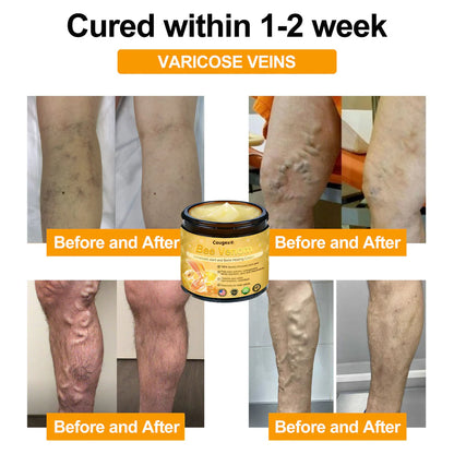 🔥Black Friday Limited Time 50% OFF🔥Bee Venom Advanced Joint and Bone Healing Cream