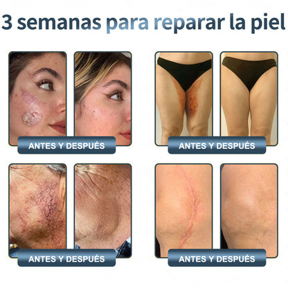 🔥Limited Time 50% OFF🔥WildYam Bee Restore Cream