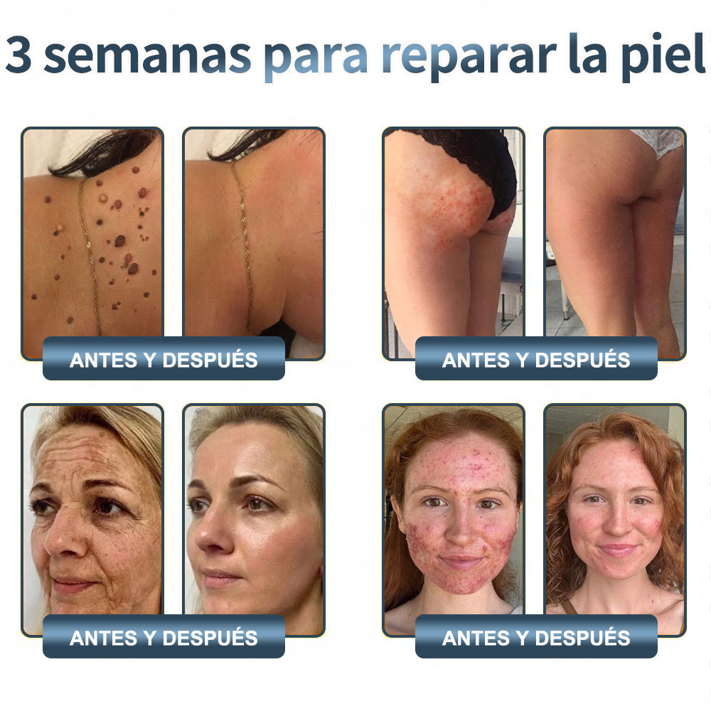 🔥Limited Time 50% OFF🔥WildYam Bee Restore Cream