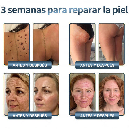 🔥Limited Time 50% OFF🔥WildYam Bee Restore Cream