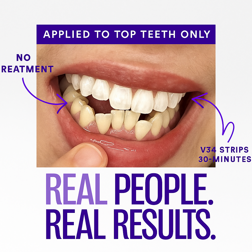 🖤 Black Friday: 2nd ltem 60% Off🦷Purple Teeth Whitening Strips