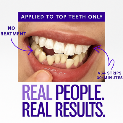 🖤 Black Friday: 2nd ltem 60% Off🦷Purple Teeth Whitening Strips