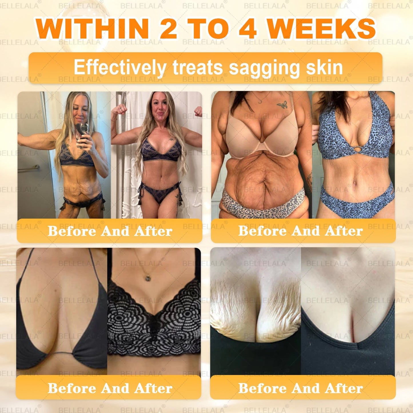 Hot Save 🥇 𝖡𝖾𝖾 𝗏𝖾𝗇𝗈𝗆 𝖲𝗄𝗂𝗇 𝖱𝖾𝗌𝗍𝗈𝗋𝖺𝗍𝗂𝗈𝗇 𝖢𝗋𝖾𝖺𝗆