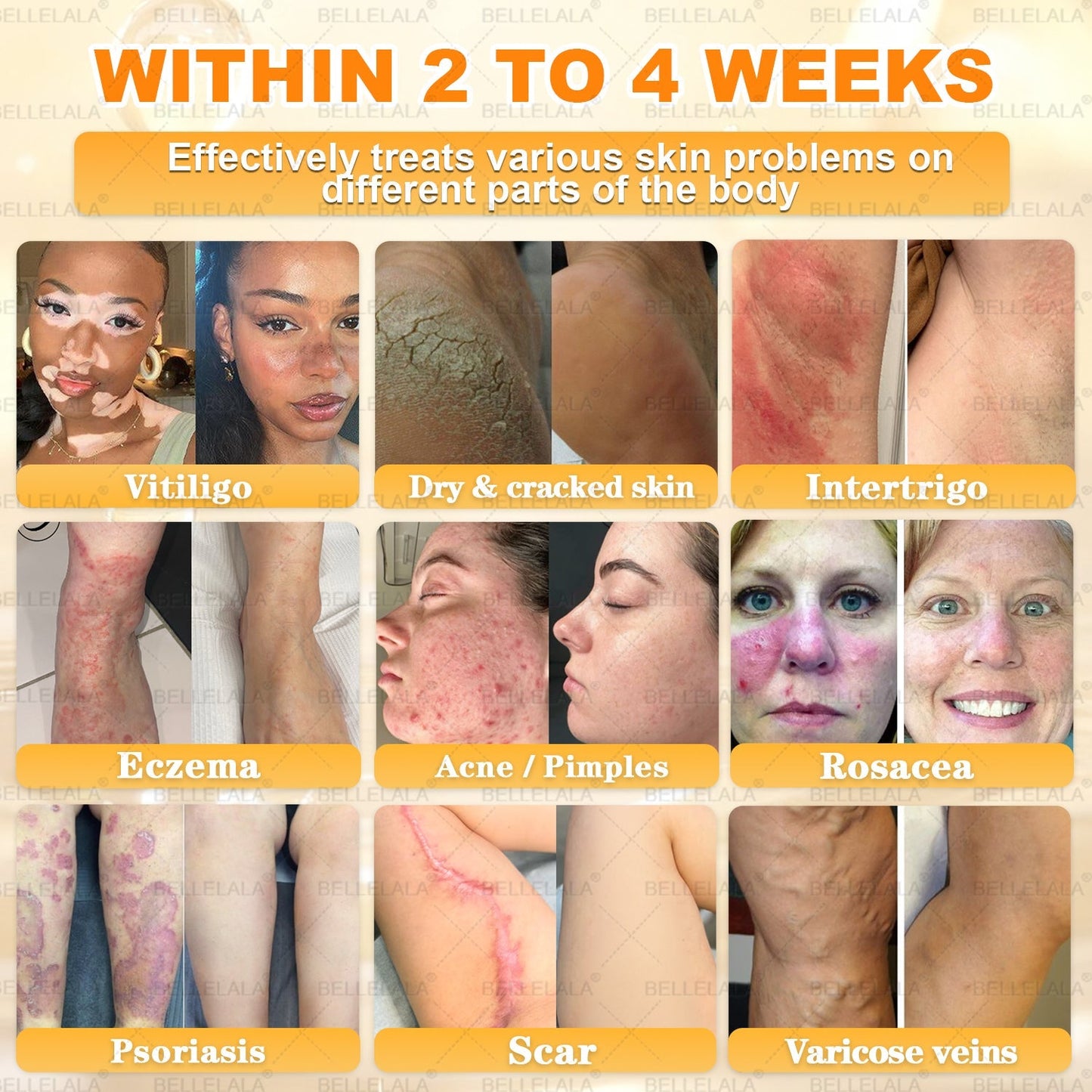 Hot Save 🥇 𝖡𝖾𝖾 𝗏𝖾𝗇𝗈𝗆 𝖲𝗄𝗂𝗇 𝖱𝖾𝗌𝗍𝗈𝗋𝖺𝗍𝗂𝗈𝗇 𝖢𝗋𝖾𝖺𝗆