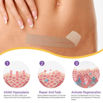 ✅Official Store |Medical GradeHyaluronic Acid Nano Microneedle Repair Tape🏥(Treatment of old and new scars, reduction of surgical scars, stretch marks, keloids, acne, burns, warts, dermatomes and varicose veins)
