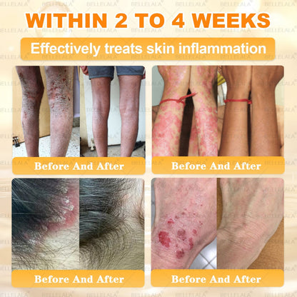 Hot Save 🥇 𝖡𝖾𝖾 𝗏𝖾𝗇𝗈𝗆 𝖲𝗄𝗂𝗇 𝖱𝖾𝗌𝗍𝗈𝗋𝖺𝗍𝗂𝗈𝗇 𝖢𝗋𝖾𝖺𝗆