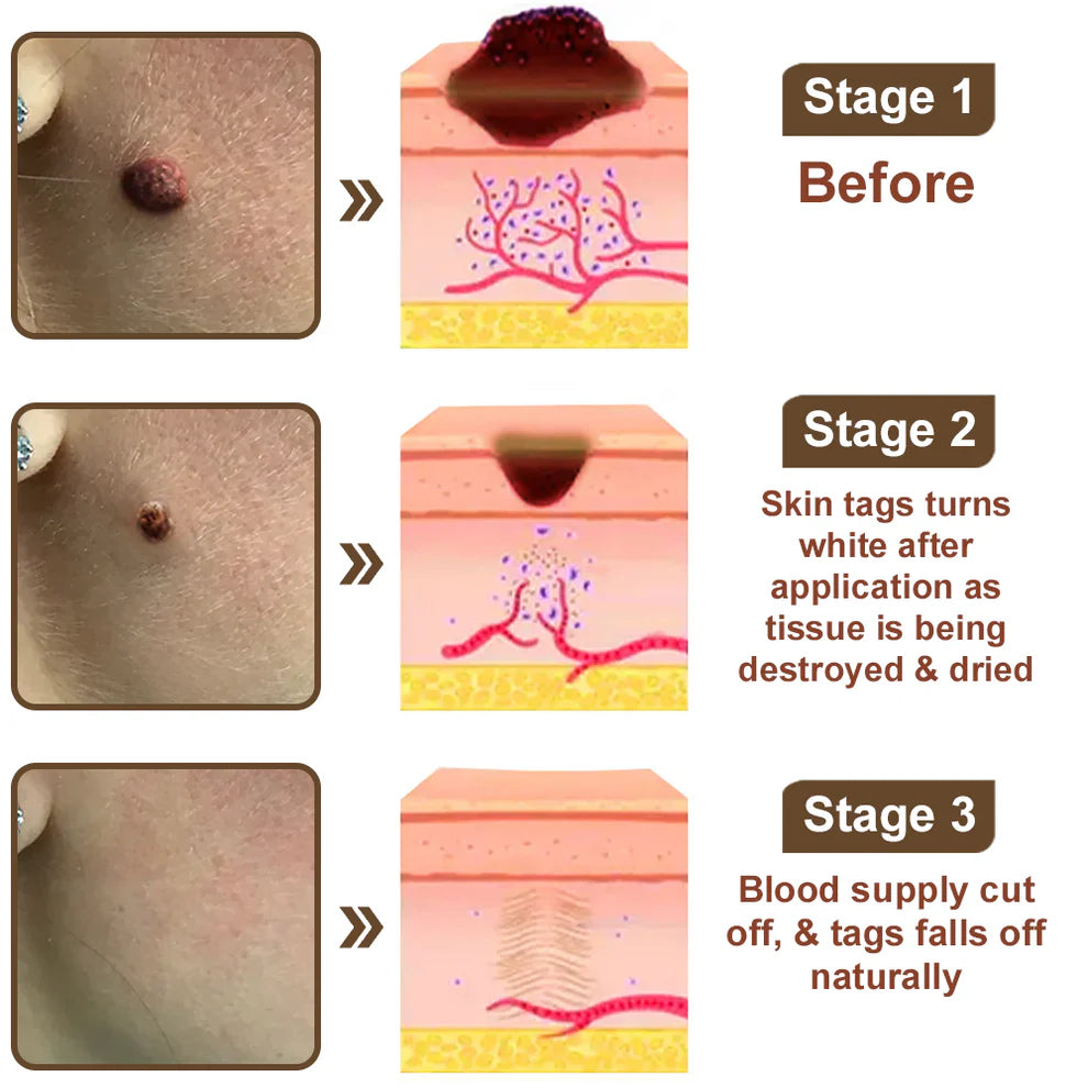 🔥First 100 :2nd ltem 60% Off🔥Black Rice Soothing Repair Cream