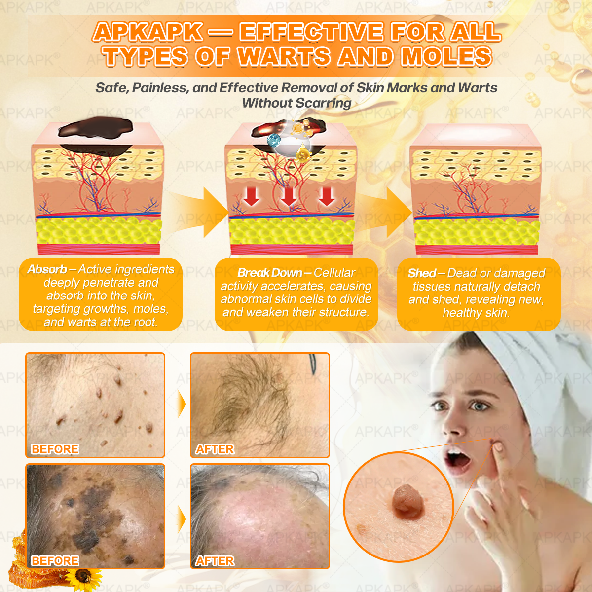 Hot Save 🥇 𝖡𝖾𝖾 𝗏𝖾𝗇𝗈𝗆 𝖲𝗄𝗂𝗇 𝖱𝖾𝗌𝗍𝗈𝗋𝖺𝗍𝗂𝗈𝗇 𝖢𝗋𝖾𝖺𝗆