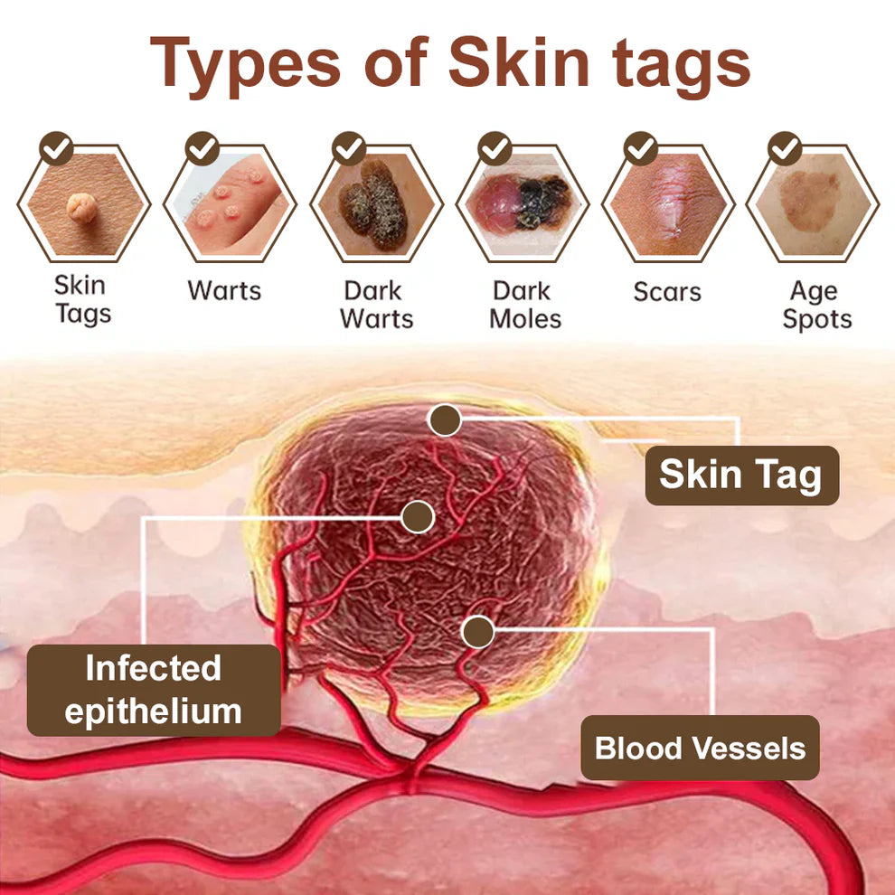 🔥First 100 :2nd ltem 60% Off🔥Black Rice Soothing Repair Cream