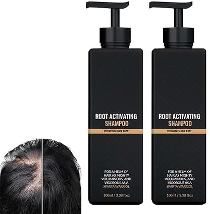 ✨Anti-hair loss shampoo, hair root activator