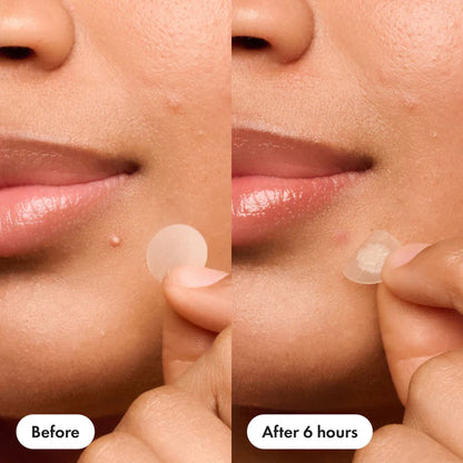 Mighty Patch™ Original patch