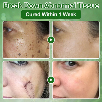 Tea Tree Oil Skin Treatment Cream✅𝐅𝐃𝐀-𝐀𝐏𝐏𝐑𝐎𝐕𝐄𝐃 – Removes Skin Blemishes, Repairs Damaged Skin, Brightens & Anti-Ageing Care