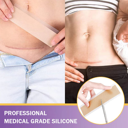 ✅Official Store |Medical GradeHyaluronic Acid Nano Microneedle Repair Tape🏥(Treatment of old and new scars, reduction of surgical scars, stretch marks, keloids, acne, burns, warts, dermatomes and varicose veins)