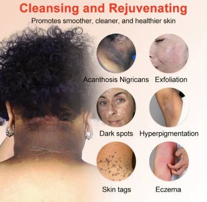 Dresfa Exfoliating Gel😍 Dark Spot & Dead Skin Remover