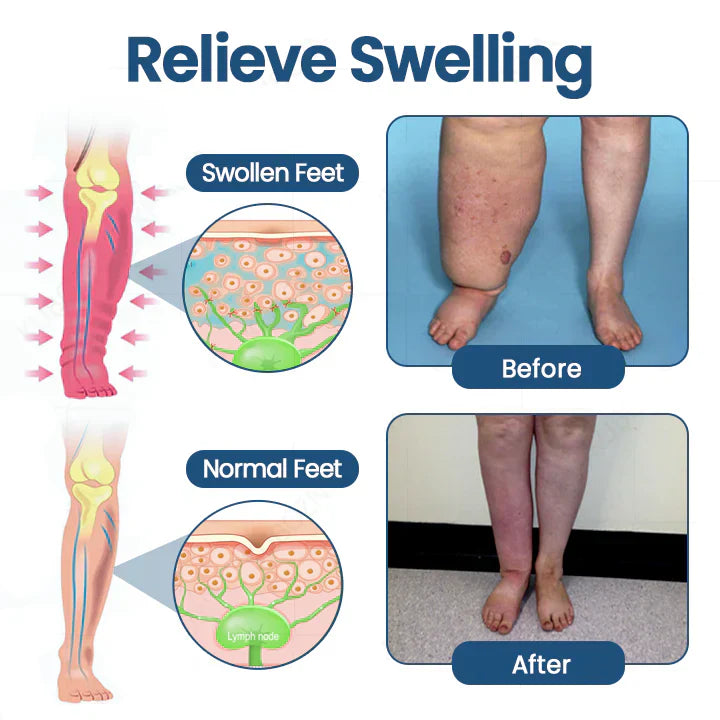 🔥First 100 :2nd ltem 60% Off🔥Roll-On Pump Cream for Lymphatic Drainage & Swelling Relief