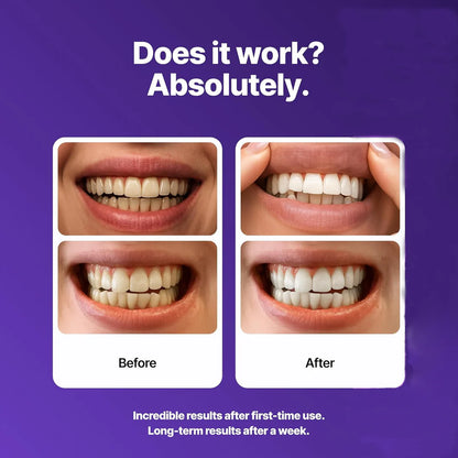 🖤 Black Friday: 2nd ltem 60% Off🦷Purple Teeth Whitening Strips