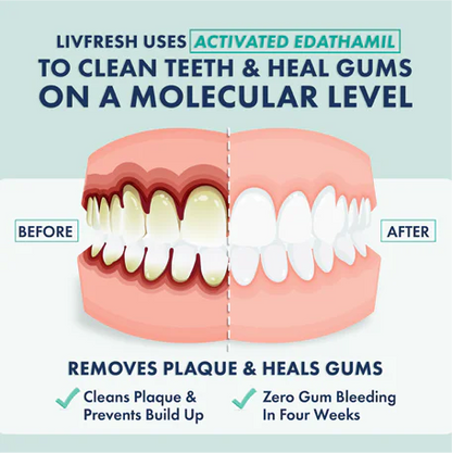 🔥Black Friday Sale: Buy 2 Get 1 Free🔥Wintergreen Gel Toothpaste